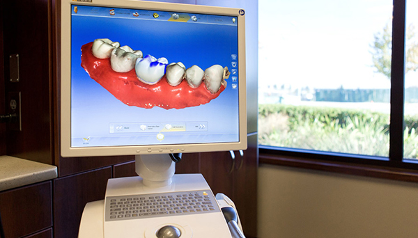 Ripon Plaza Dental   Escalon Family Dental  | Dental Bridges, Extractions and Emergency Treatment