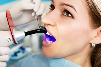 Ripon Plaza Dental   Escalon Family Dental | Digital Radiography, Emergency Treatment and Dental Fillings