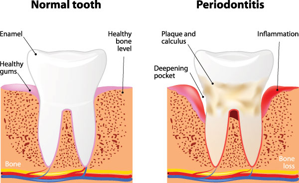 Ripon Plaza Dental   Escalon Family Dental | Dentures, Night Guards and Teeth Whitening