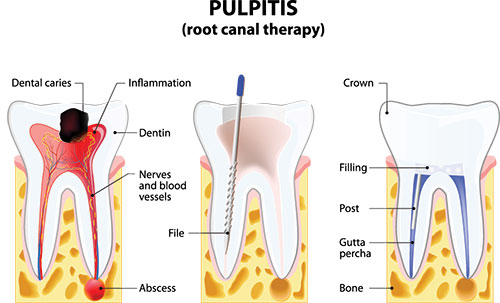 Ripon Plaza Dental   Escalon Family Dental | Digital Radiography, Periodontal Treatment and Dental Bridges