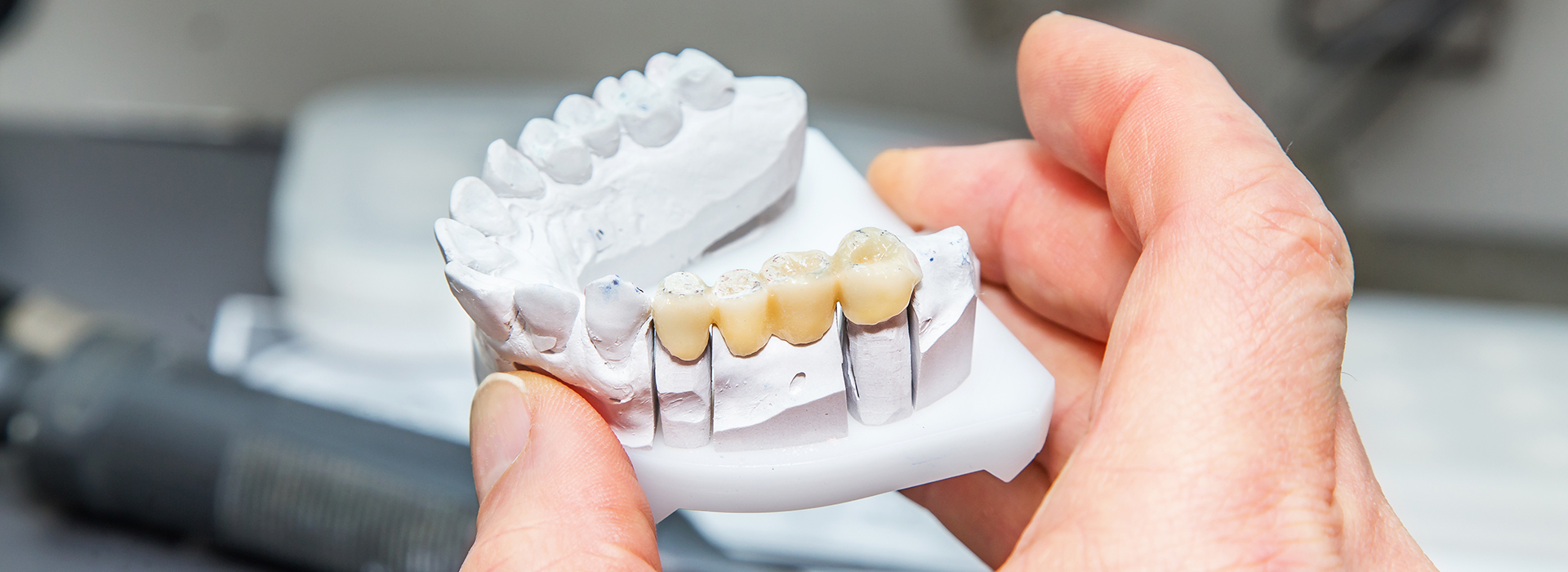 Ripon Plaza Dental   Escalon Family Dental | Digital Radiography, Pediatric Dentistry and Night Guards